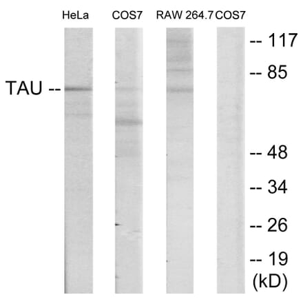 Western Blot - Anti-Tau Antibody (B7238) - Antibodies.com