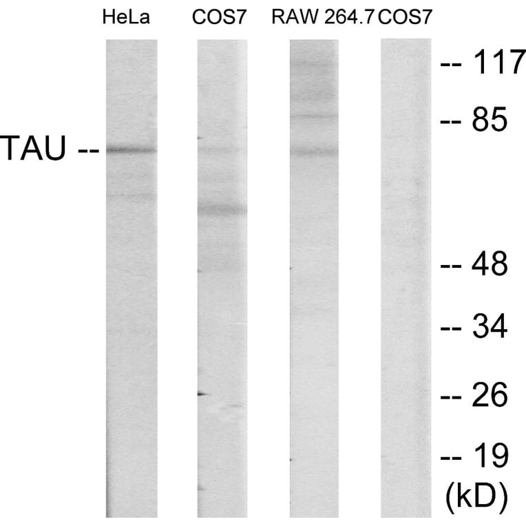 Western Blot - Anti-Tau Antibody (B7238) - Antibodies.com