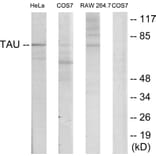 Western Blot - Anti-Tau Antibody (B7238) - Antibodies.com