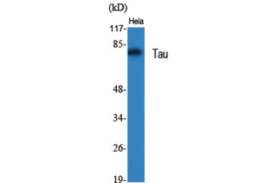 Western Blot - Anti-Tau Antibody (B7238) - Antibodies.com