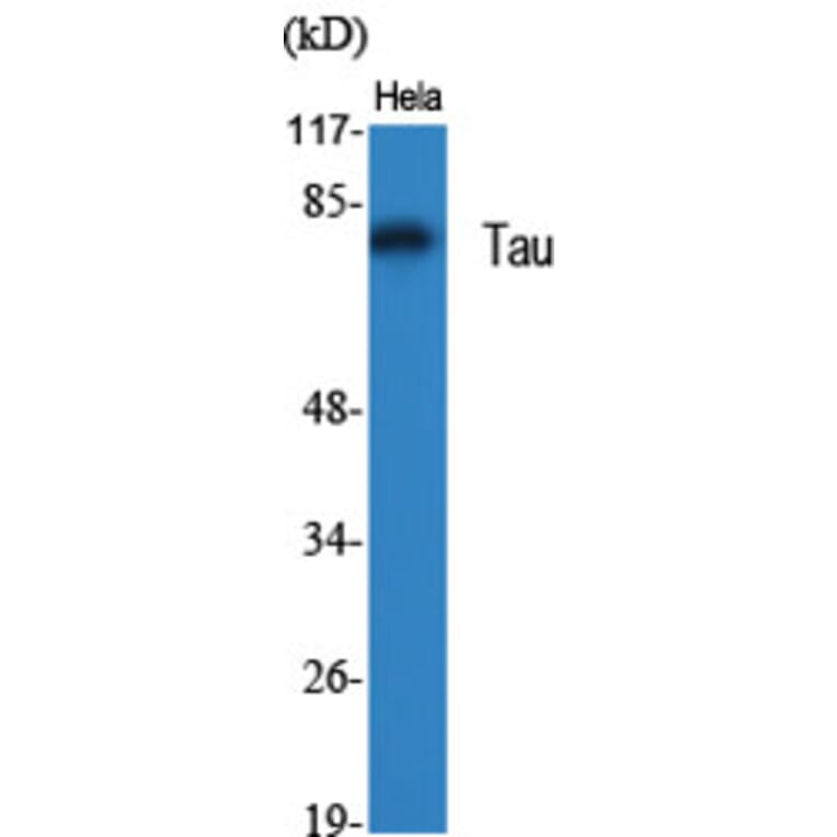 Western Blot - Anti-Tau Antibody (B7238) - Antibodies.com