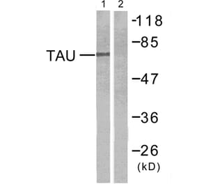 Western Blot - Anti-Tau Antibody (B7246) - Antibodies.com