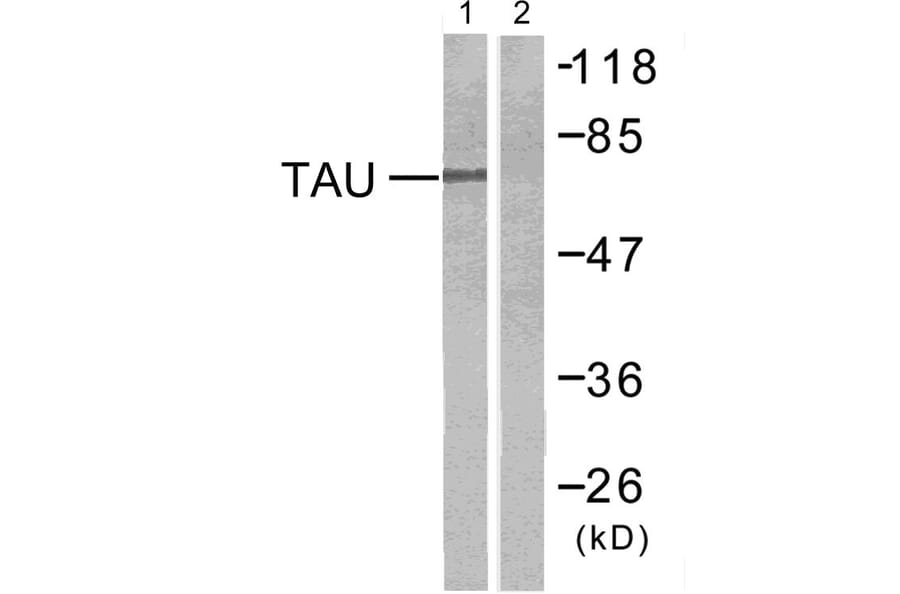 Western Blot - Anti-Tau Antibody (B7246) - Antibodies.com