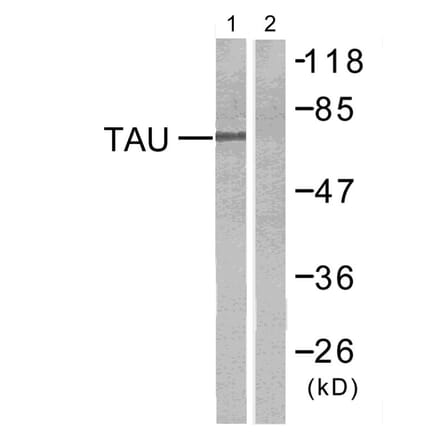 Western Blot - Anti-Tau Antibody (B7246) - Antibodies.com