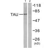 Western Blot - Anti-Tau Antibody (B7246) - Antibodies.com