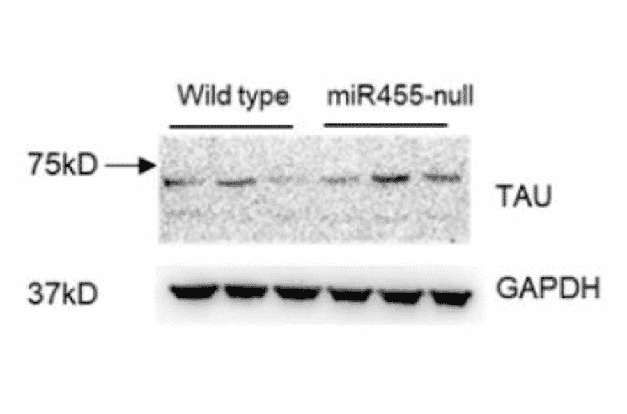 Western Blot - Anti-Tau Antibody - Antibodies.com