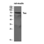 Western Blot - Anti-Tau Antibody (B7246) - Antibodies.com
