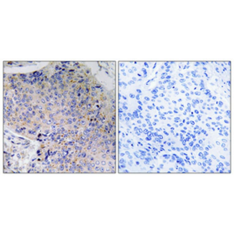 Immunohistochemistry - Anti-Tau Antibody (B7246) - Antibodies.com