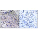 Immunohistochemistry - Anti-Tau Antibody (B7246) - Antibodies.com