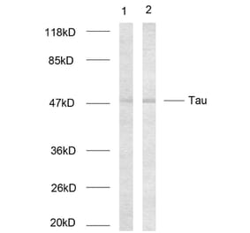 Western Blot - Anti-Tau Antibody (B7237) - Antibodies.com