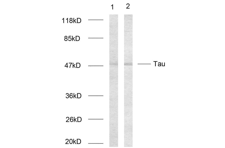 Western Blot - Anti-Tau Antibody (B7237) - Antibodies.com