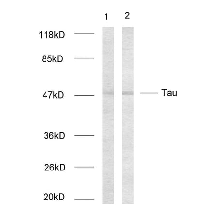 Western Blot - Anti-Tau Antibody (B7237) - Antibodies.com