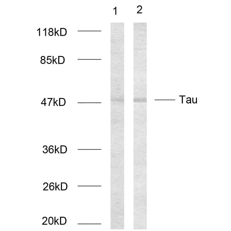 Western Blot - Anti-Tau Antibody (B7237) - Antibodies.com