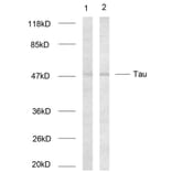 Western Blot - Anti-Tau Antibody (B7237) - Antibodies.com