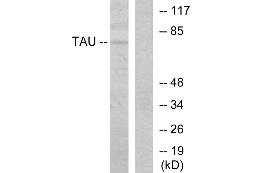 Western Blot - Anti-Tau Antibody (B7245) - Antibodies.com