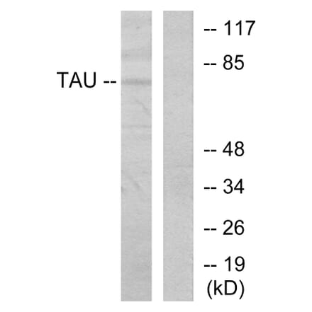 Western Blot - Anti-Tau Antibody (B7245) - Antibodies.com