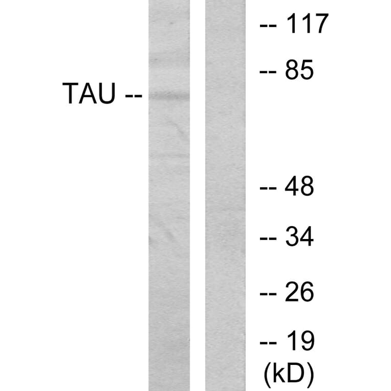 Western Blot - Anti-Tau Antibody (B7245) - Antibodies.com