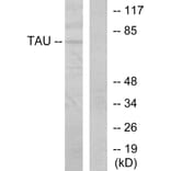 Western Blot - Anti-Tau Antibody (B7245) - Antibodies.com