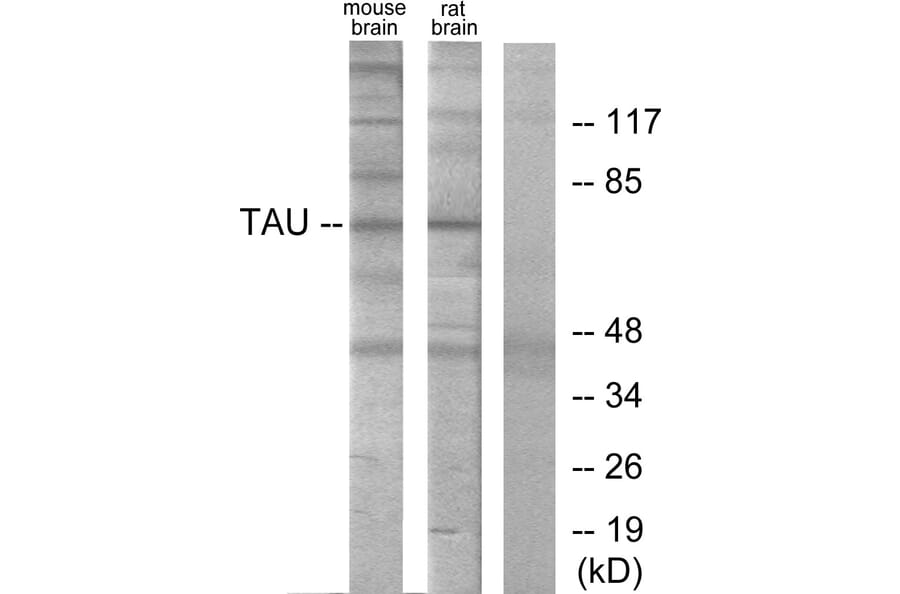 Western Blot - Anti-Tau Antibody (B7240) - Antibodies.com