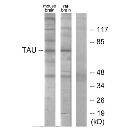 Western Blot - Anti-Tau Antibody (B7240) - Antibodies.com