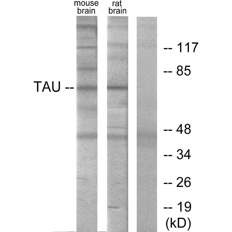Western Blot - Anti-Tau Antibody (B7240) - Antibodies.com