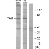 Western Blot - Anti-Tau Antibody (B7240) - Antibodies.com