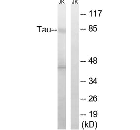 Western Blot - Anti-Tau Antibody (B8067) - Antibodies.com