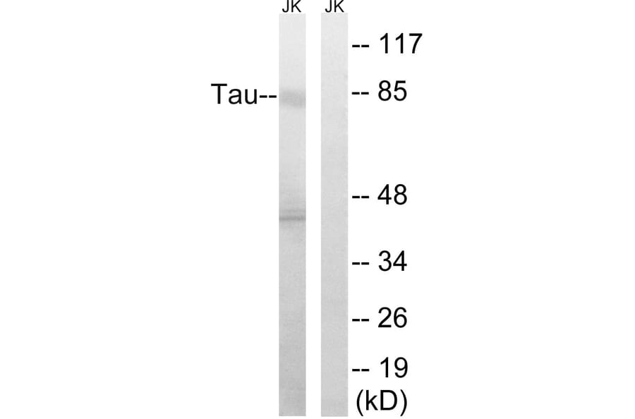 Western Blot - Anti-Tau Antibody (B8067) - Antibodies.com