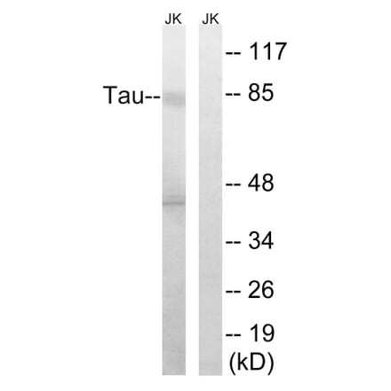 Western Blot - Anti-Tau Antibody (B8067) - Antibodies.com