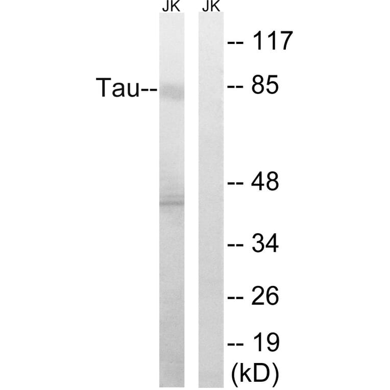 Western Blot - Anti-Tau Antibody (B8067) - Antibodies.com