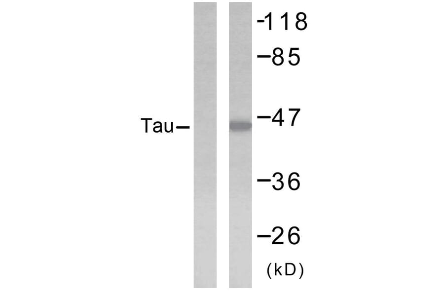 Western Blot - Anti-Tau Antibody (B7242) - Antibodies.com