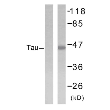 Western Blot - Anti-Tau Antibody (B7242) - Antibodies.com