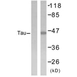 Western Blot - Anti-Tau Antibody (B7242) - Antibodies.com