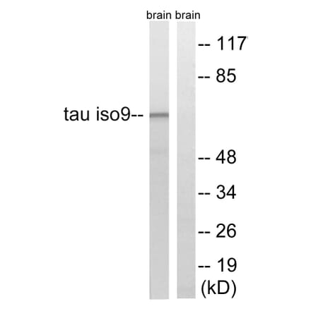 Western Blot - Anti-Tau Antibody (B8068) - Antibodies.com