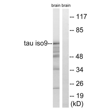 Western Blot - Anti-Tau Antibody (B8069) - Antibodies.com