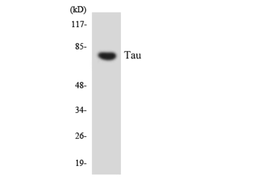 Western Blot - Anti-Tau Antibody (R12-3598) - Antibodies.com