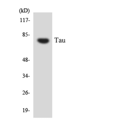 Western Blot - Anti-Tau Antibody (R12-3598) - Antibodies.com