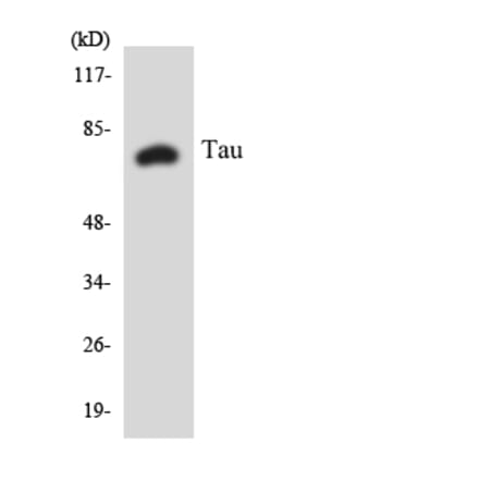 Western Blot - Anti-Tau Antibody (R12-3599) - Antibodies.com