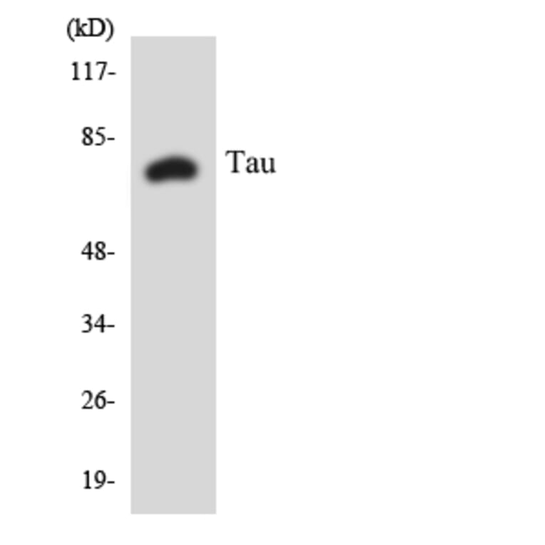 Western Blot - Anti-Tau Antibody (R12-3599) - Antibodies.com