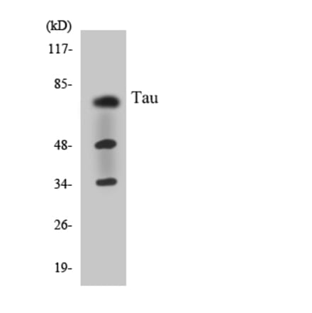 Western Blot - Anti-Tau Antibody (R12-3600) - Antibodies.com