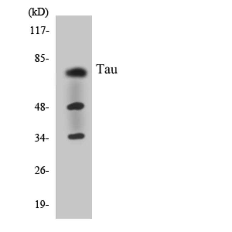 Western Blot - Anti-Tau Antibody (R12-3600) - Antibodies.com