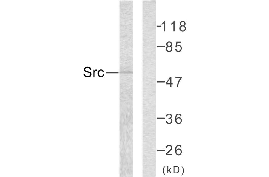 Western Blot - Anti-Src Antibody (B7219) - Antibodies.com