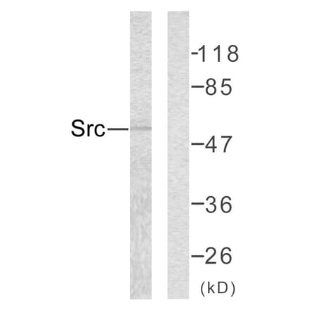 Western Blot - Anti-Src Antibody (B7219) - Antibodies.com