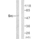 Western Blot - Anti-Src Antibody (B7219) - Antibodies.com