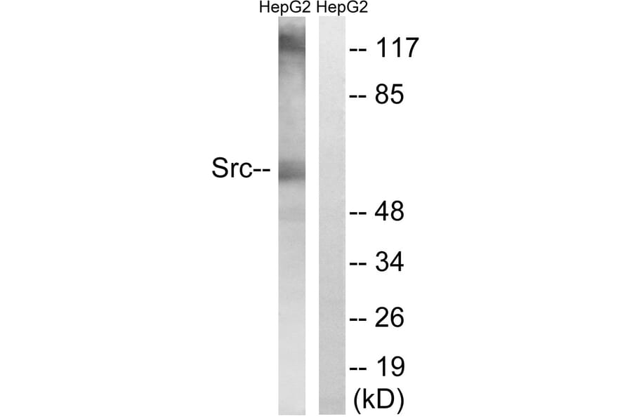 Western Blot - Anti-Src Antibody (B8237) - Antibodies.com