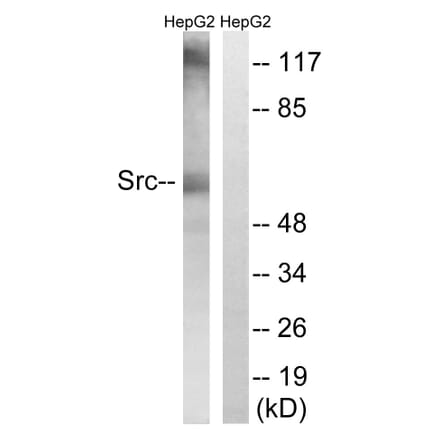 Western Blot - Anti-Src Antibody (B8237) - Antibodies.com