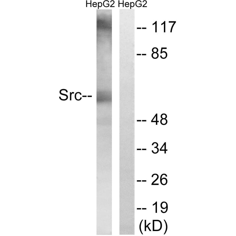 Western Blot - Anti-Src Antibody (B8237) - Antibodies.com