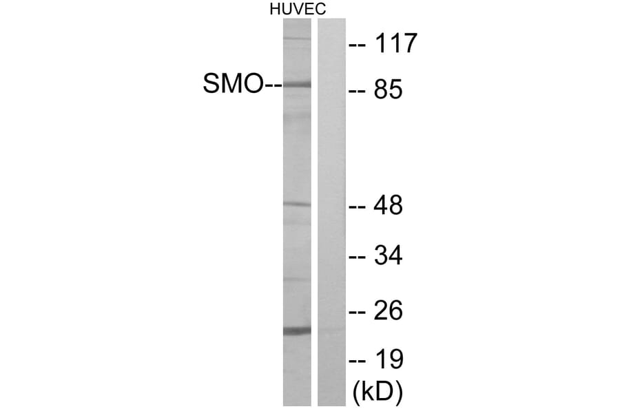 Western Blot - Anti-SMO Antibody (G743) - Antibodies.com