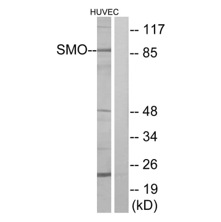 Western Blot - Anti-SMO Antibody (G743) - Antibodies.com