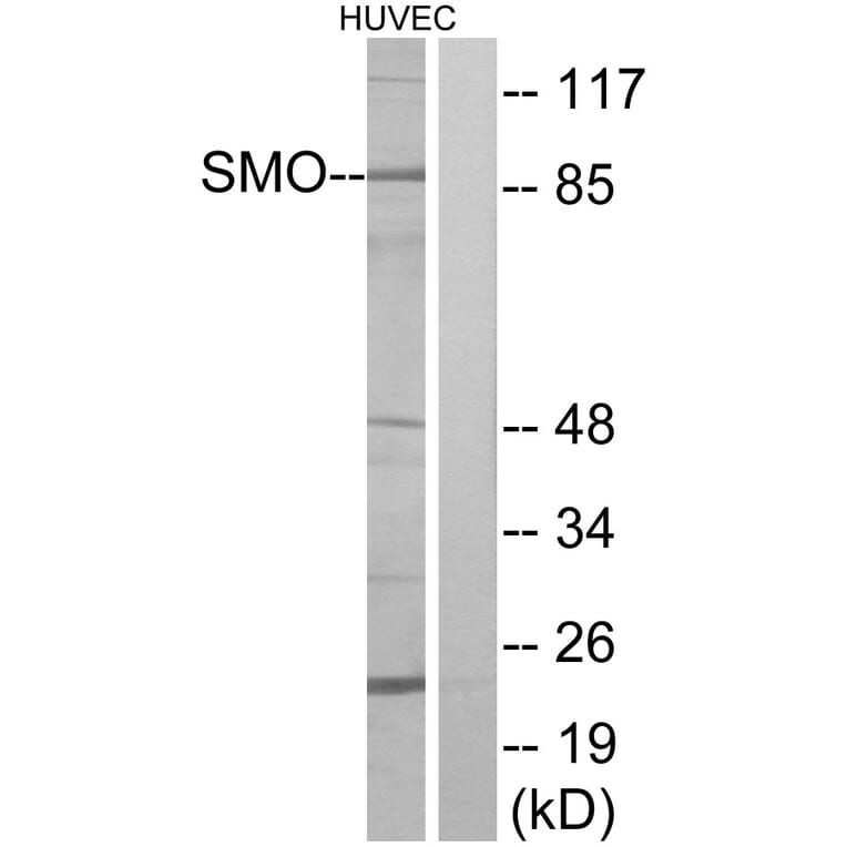 Western Blot - Anti-SMO Antibody (G743) - Antibodies.com